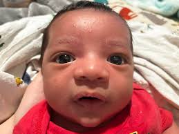 I am seeking advice regarding my 13-year-old daughter, who has developed  tiny bumps