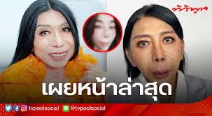 หลังจากที่แม่ สิตางศุ์ บัวทอง เจ้าของวลีเด็ดส้มหยุด ได้ตัดสินใจผ่าตัดใหญ่ศัลยกรรมยกหน้า เพราะไม่ขอทนให้คนมาบูลลี่อีกต่อไปแล้ว โดยทำการ. E27zykvl9ns4gm