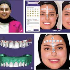 PDF) Dental implant placement with immersive technologies: A preliminary  clinical report of augmented and mixed reality applications