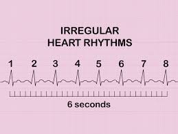 How To Measure And Calculate Heart Rate From Ecg Expert