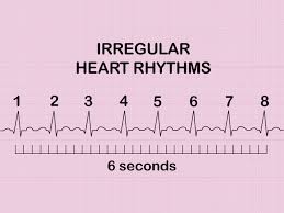 how to measure and calculate heart rate from ecg expert