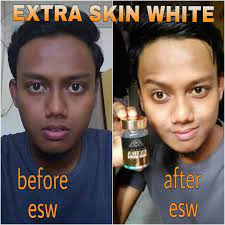 Extra skin white is a popular song by alfhzrn | create your own tiktok videos with the extra skin white song and explore 116 videos made by new and popular creators. Kenapa Perlu Extra Skin White Kapsul Mencerahkan Kulit Facebook