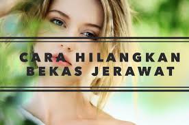 Parut, parut parut kecil, parut jerawat, lepuh atau luka akibat jatuh atau benda tajam yang dihiris, baik di badan dan di muka, boleh menjejaskan keyakinan seseorang. Produk Untuk Hilangkan Bekas Jerawat Berlubang Kesihatan Dan Kecantikan