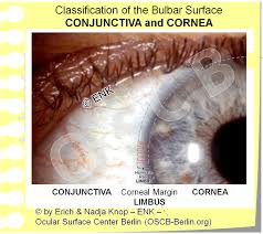 Image result for Cornea