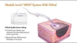 We did not find results for: Negative Pressure Wound Therapy Medela Us