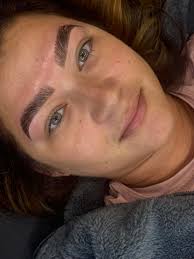 Before + afters never cease to...