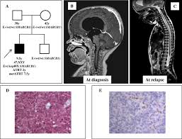 Signs and symptoms may be caused by atrt or by other conditions. Case Report Long Term Survival Of An Infant Syndromic Patient Affected By Atypical Teratoid Rhabdoid Tumor Bmc Cancer Full Text
