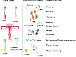 Endometrial cancer 3d ultrasound most physicians are familiar with the classic endometrial cancer symptoms and signs — notably, abnormal premenopausal bleeding and postmenopausal bleeding. Liquid Biopsy In Endometrial Cancer