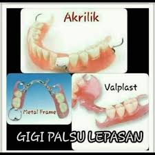 Maybe you would like to learn more about one of these? Pasang Gigi Palsu Dan Behel Gigi Home Facebook