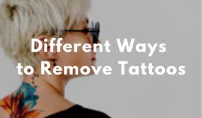 Avoid using painful, dangerous diy attempts that you'll immediately regret. Different Ways To Remove Tattoos Excision Creams Injections And Laser Treatments