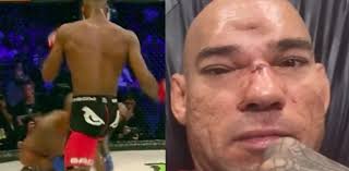 Six months after Michael Venom Page's flying knee fractured his skull,  Evangelista Santos retires