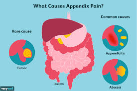 In an appendix, endocrine cells are used to produce various biogenic amines and peptide it has a role in our body, but it isn't essential. Appendix Pain Causes Treatment And When To See A Doctor