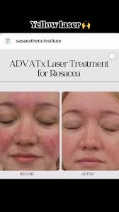 Nocoaestheticsstudio