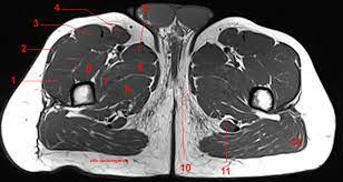 • acromion • clavicle • deltoid ( im injections) • humerus • biceps muscle • biciptal groove • brachila pulse( blood b) supplies most of the intrinsic muscles of the hand including the hypothenar eminence, and skin on the medial side of the hand. Mri Of The Thigh Detailed Anatomy Superior Part W Radiology