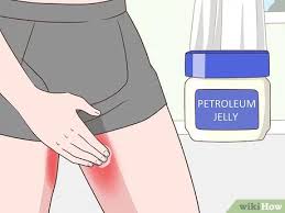 3 Modi Per Prevenire L Irritazione Da Sfregamento Tra Le Gambe