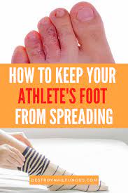 Should I Wear Socks To Bed With Athlete S Foot