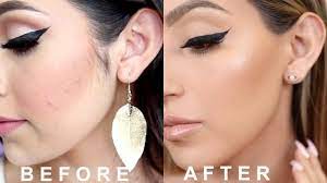 Facial laser hair removal for women, laser hair removal for women. How I Remove My Sideburns Peach Fuzz Youtube