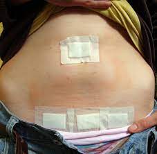Chirurgie Operationen Mussen Keine Narben Mehr Hinterlassen Welt
