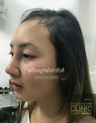 We did not find results for: à¸£ à¸Šà¹‚à¸¢à¸˜ à¸™à¸„à¸¥ à¸™ à¸ Ratchayothin Clinic Home Facebook