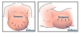 Image result for Puddle Sign