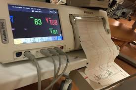 Kadın hastalıkları ve doğum uzmanlarının en sık kullandığı test yöntemlerinden biri de. Nst Nedir