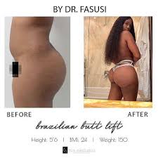 Home to sunny skies, beautiful weather, picturesque beach. Dr Fasusi Plastic Surgeon Mia Aesthetics Cosmetic Surgery