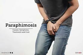 Image result for paraphimosis
