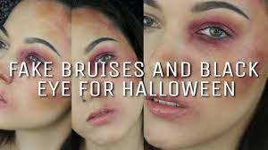 bruise with regular makeup