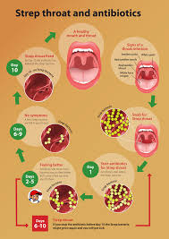 Sore Throat Ministry Of Health Nz