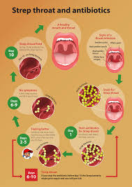Why your throat hurts and how to cure a sore throat. Sore Throat Ministry Of Health Nz