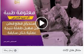 استخراج قطع قطن منسيه من طفلة بعد عميلة ختان سابقة شرح تحليلي من داخل غرفة العمليات وتوضيح مشاكل ختان الإناث مع د Incoming Call Screenshot Incoming Call Videos