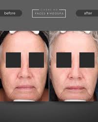 Faces Medspa and Givens MD Facial Plastic Surgery