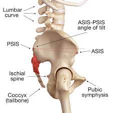 The philippine society for industrial security (psis) is the philippine's largest organization of security professionals. Image Result For Psis Asis Anatomy Pelvic Tilt Pelvis Anatomy Anatomy