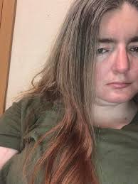 what to do with splotchy gray hair?