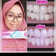 Drw Skin Care Cikampek Posts Facebook