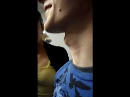 Adam's apples develop during puberty and are not present in prepubescent children. Huge Adam S Apple Youtube