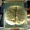 See where the different parts are and what they do with this webmd it has two main parts: 1