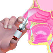 1960 wurde das fentanyl als synthetisches opioid entwickelt und steht heute in verschiedenen derivaten, intravenös als narkosemittel als transdermales pflaster, in flüssiger form als nasenspray (pecfent) als brausetablette zum auflösen in der wangentasche (effentora), oder als tablette zur auflösung unter der zunge. Pflege Home Pflege Aktuell Anasthesie Demenz Diabetes Ernahrung Geriatrie Altenpflege Intensivpflege Kinder Und Pflege Kontinenz Inkontinenz Pflege Multiple Sklerose Obstipation Constipation Care Osteoporose Pflege Pah Palliativpflege
