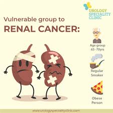 Early Diagnosis Of Renalcancer Can Decrease Its Impact On Your Body To Learn More About It Checkout Http Www Urologyspecialit Renal Cancer Doctor Cancer