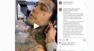 Yeferson cossio por pago de impuestos . Yeferson Cossio Compartio Impactantes Imagenes Del Accidente Que Lo Dejo Invalido