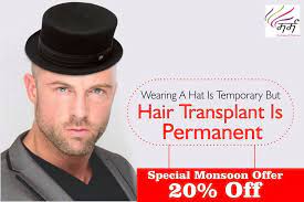 Do Not Hide Your Baldness Get Hair Transplant By Best Hair Surgeon Hair Transplant In Indore Hair Transplant Cool Hairstyles Hairfall Treatment