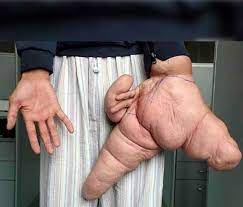 We did not find results for: 10 World Records Related To Incredible Body Parts