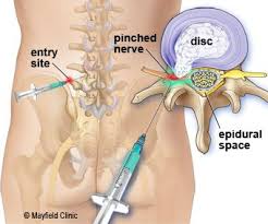 Pin On Spine