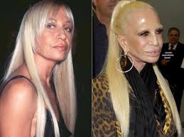 10 Of The Most Unfortunate Cases Of Plastic Surgery In Hollywood Bad Celebrity Plastic Surgery Celebrity Plastic Surgery Plastic Surgery Fail