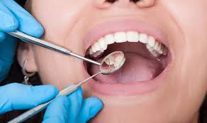 While you might find a prosthodontist willing to provide pro bono services, other providers are involved in the process. Free Governments Grant For A Dental Implant 2021