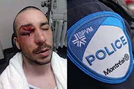 Le SPVM condamné à payer 175 000$ à un jeune homme