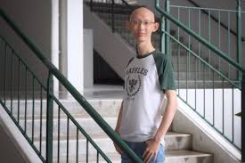 The stall assistant from the raffles institution's canteen tested positive for infection on saturday (17 july). A Level Results Ri Graduate Teased For His Birth Defects In Primary School Scores Straight As Singapore News Asiaone