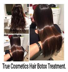 Botox usually lasts about four months. Facebook