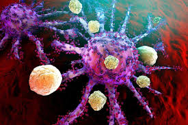 A Type Of Immune Cell Has Been Found Inside Tumours That Helps Our Bodies Mount Attacks Against Cancer Boosting These In 2020 Natural Cancer Immunotherapy Cancer Cell
