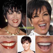 Dental Assistant Jobs Near Me 2020 Dental Assistant Dental Makeover Dental Assistant Jobs